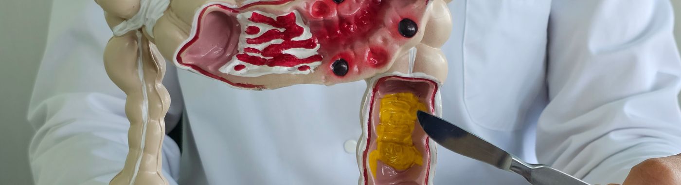 Small Bowel Transplant - Procedures, Preparation, Cost, and Recovery