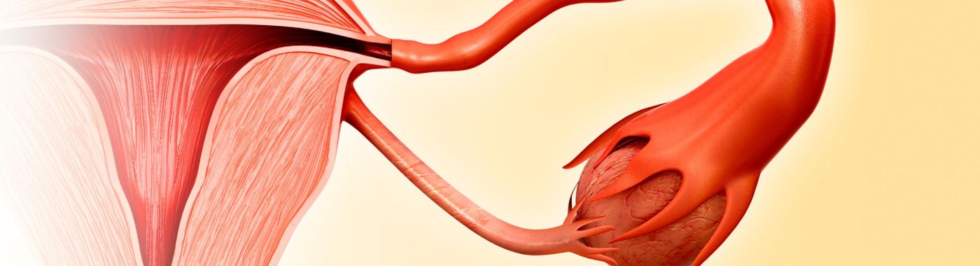 Uterine Artery Embolization - Procedures, Preparation, Cost, and Recovery