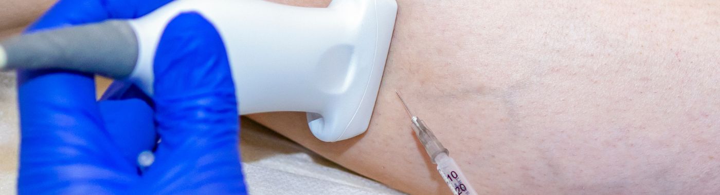 VenaSeal Closure - Procedures, Preparation, Cost, and Recovery