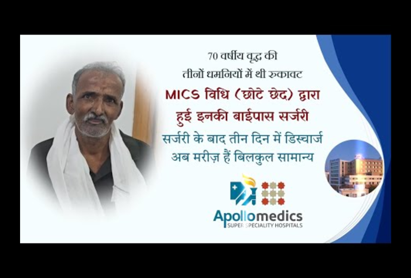 MICS (small incision) bypass surgery