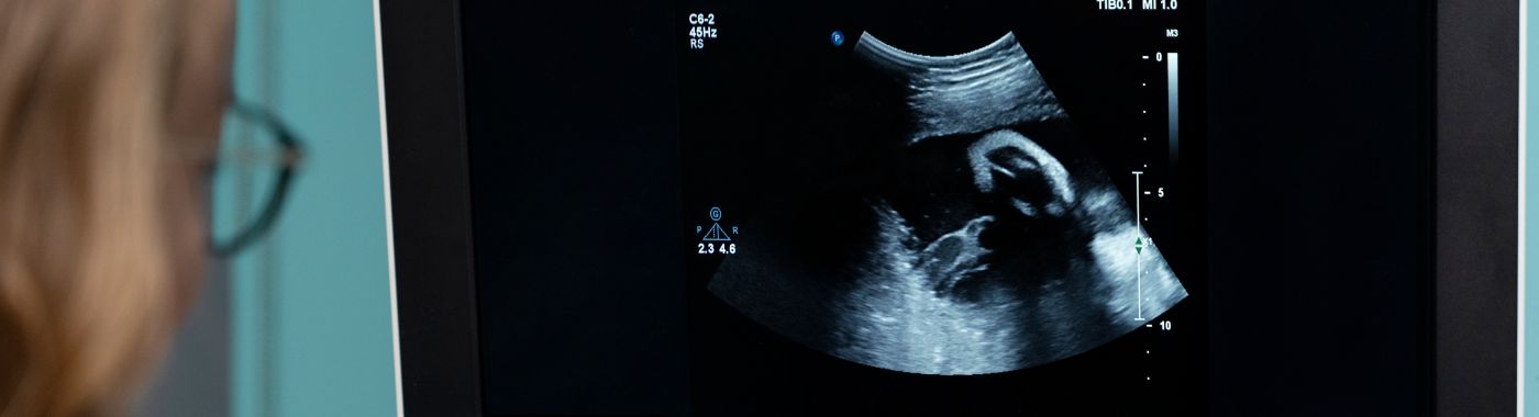 2d-echo-test-meaning
