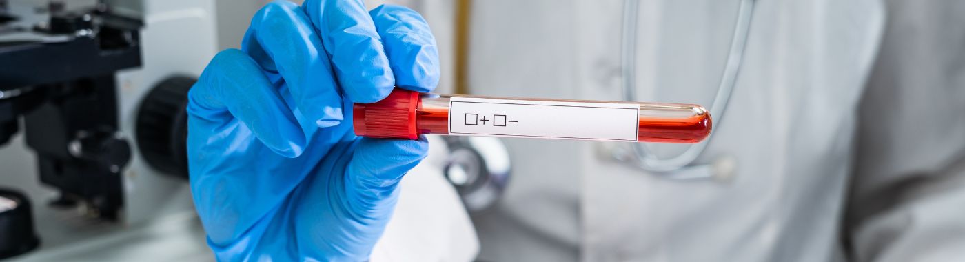 Adenosine Deaminase Test