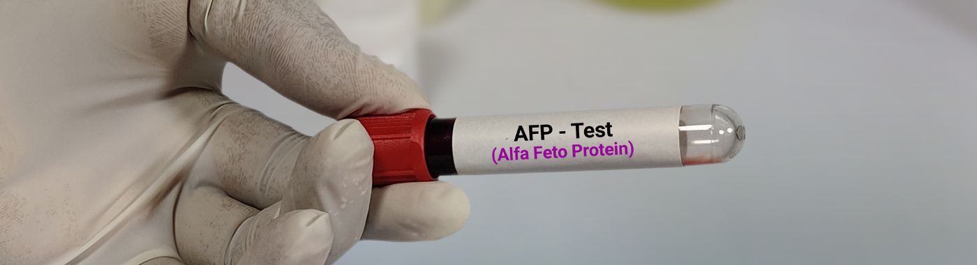 AFP Test (Alpha-Fetoprotein)