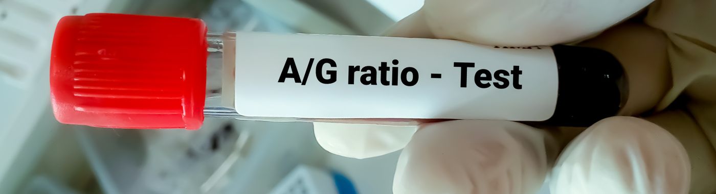 AG Ratio Test