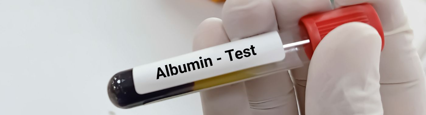 Albumin Test