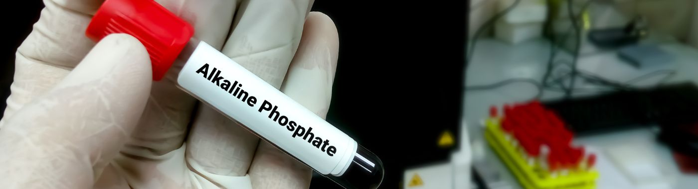 Alkaline Phosphatase Test