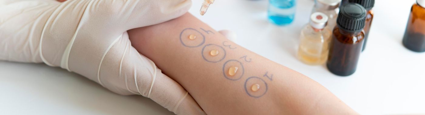 Allergy Skin Test