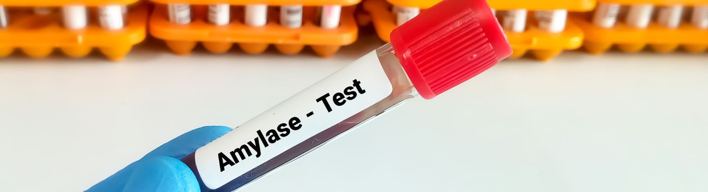 Amylase Test