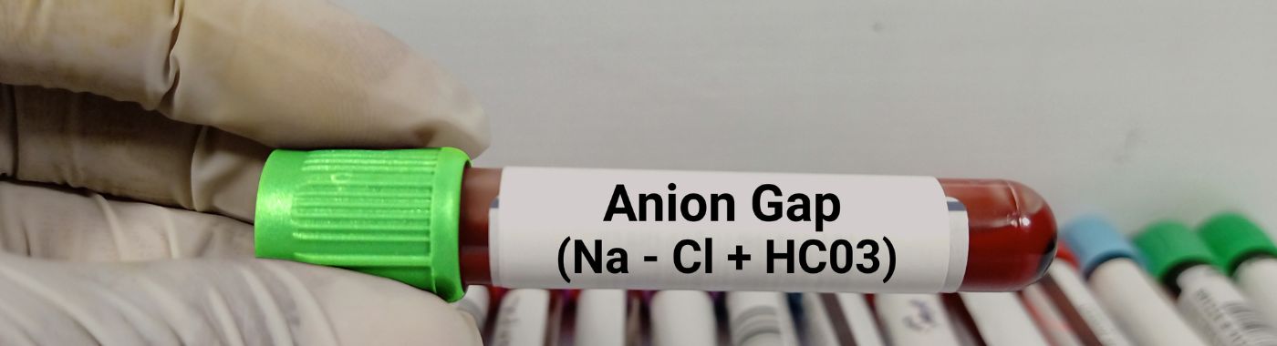 Anion Gap Blood Test