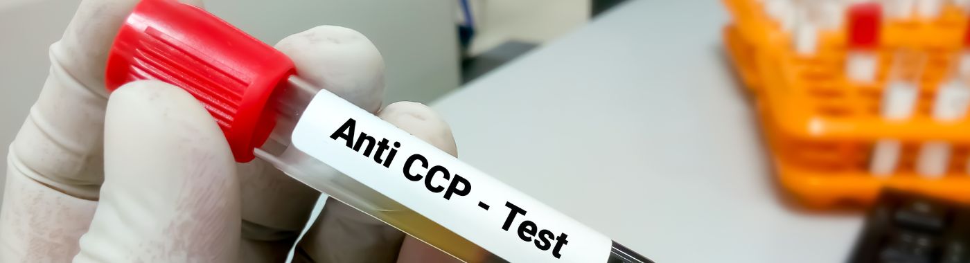 Anti CCP Test