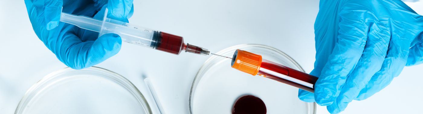 Antithyroglobulin Antibody Test