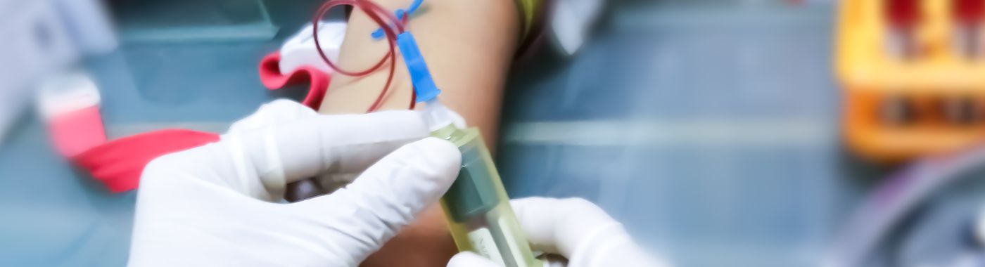 Paglalagay ng Arteriovenous Graft (AV Graft) - Gastos, Mga Indikasyon, Paghahanda, Mga Panganib, at Paggaling