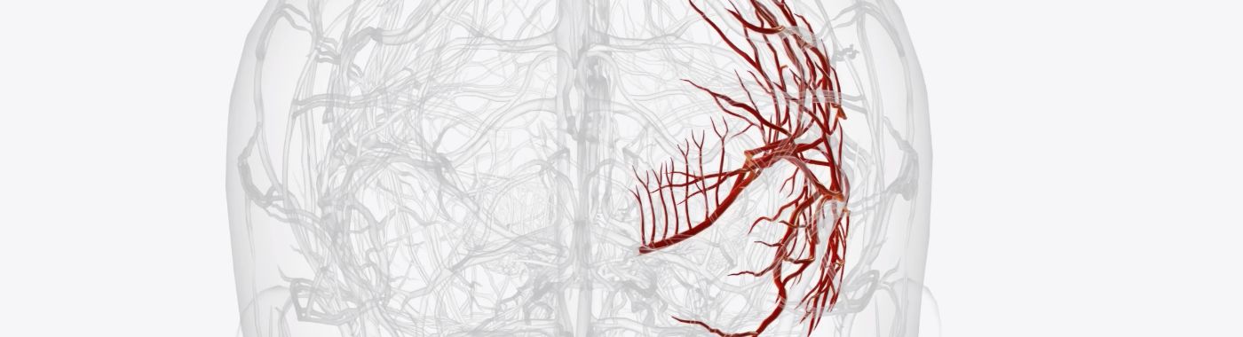 Артериовенозная мальформация (АВМ) — стоимость, показания, подготовка, риски и восстановление.