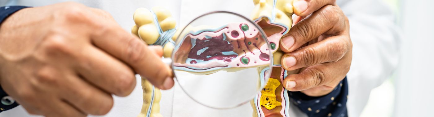 Имплантация искусственного сфинктера кишечника: стоимость, показания, подготовка, риски и восстановление.