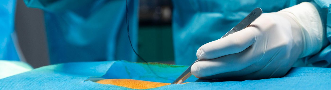 AV Fistula Creation - Cost, Indications, Preparation, Risks, and Recovery