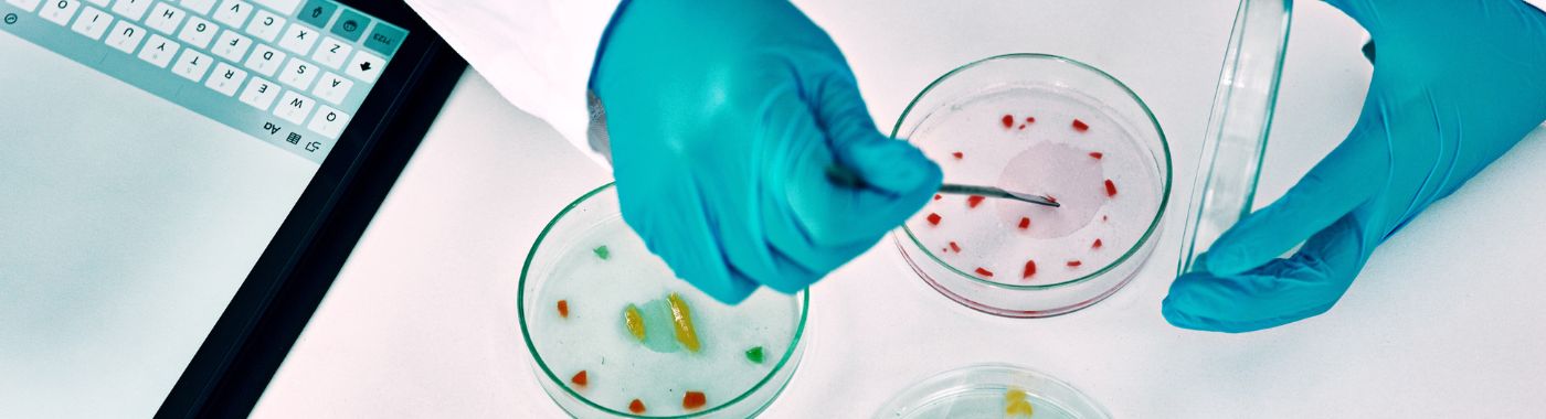 Bacteria Culture Test