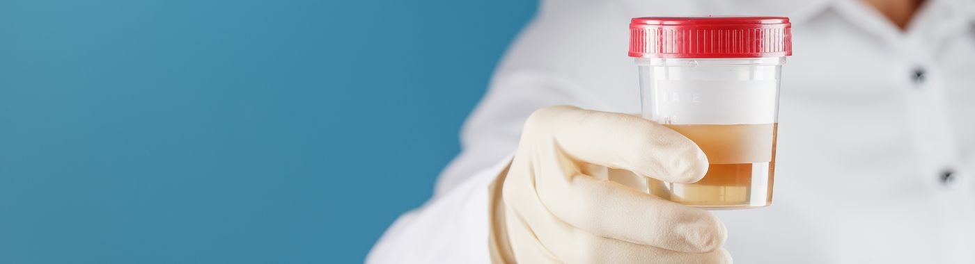 Bacterial Vaginosis Test