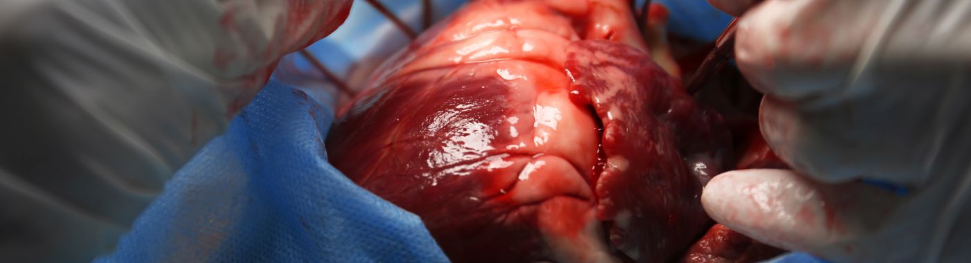 Ballong-aorta-klaffplastikk - Kostnad, indikasjoner, forberedelse, risikoer og rekonvalesens