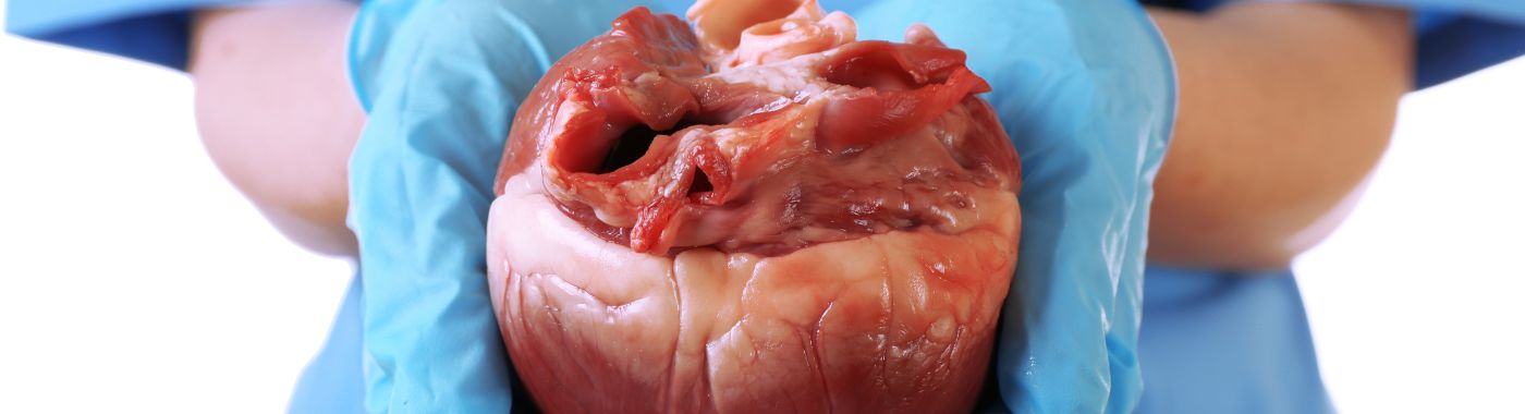 Balloon Septostomy - Gastos, Indikasyon, Paghahanda, Mga Panganib, at Paggaling