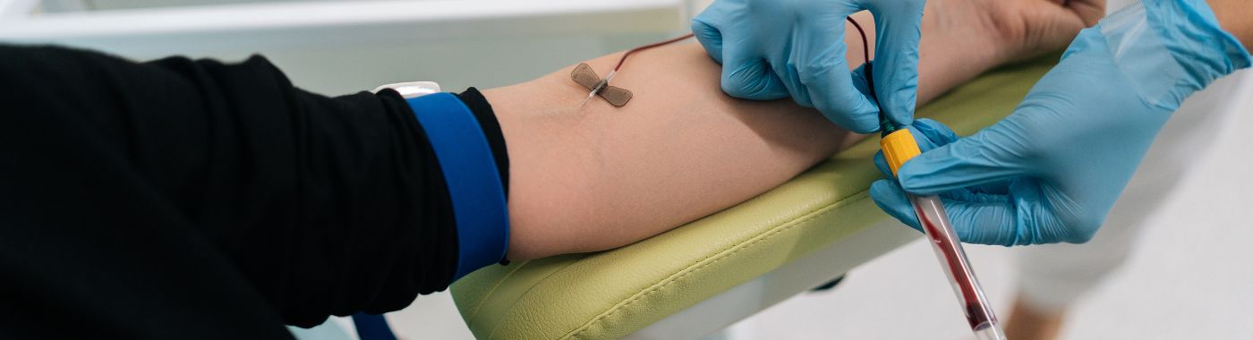 Basic Metabolic Panel (BMP) Test