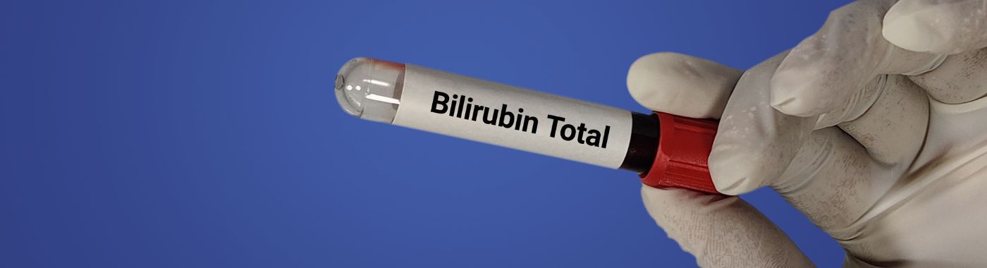 Bilirubin Blood Test