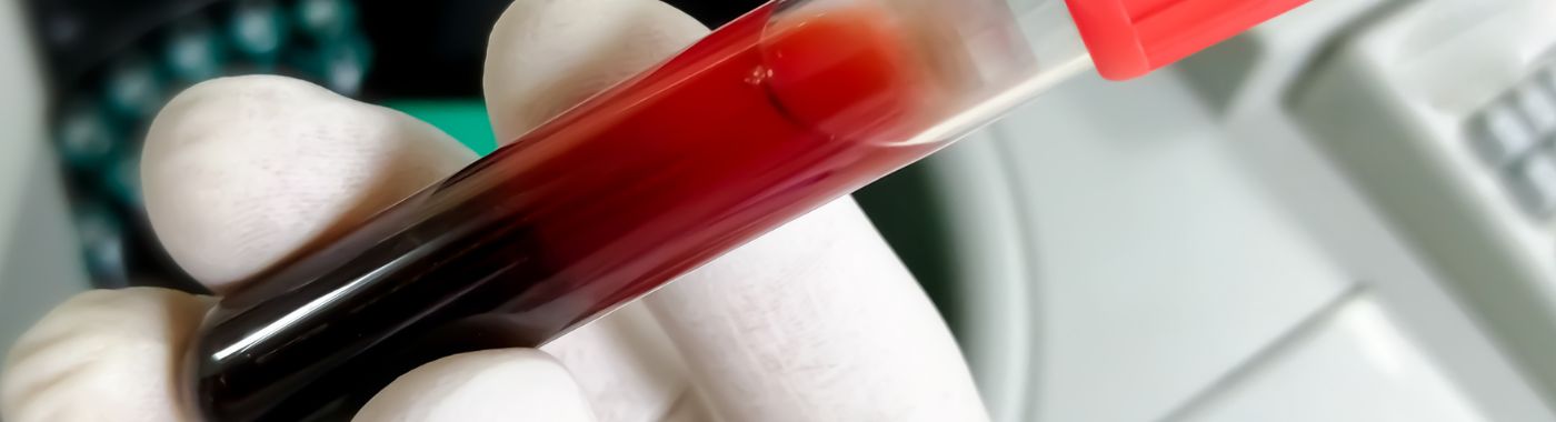 Blood Urea Nitrogen (BUN) Test