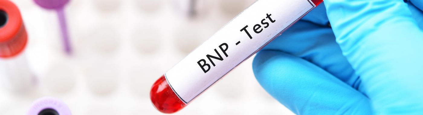 BNP Test