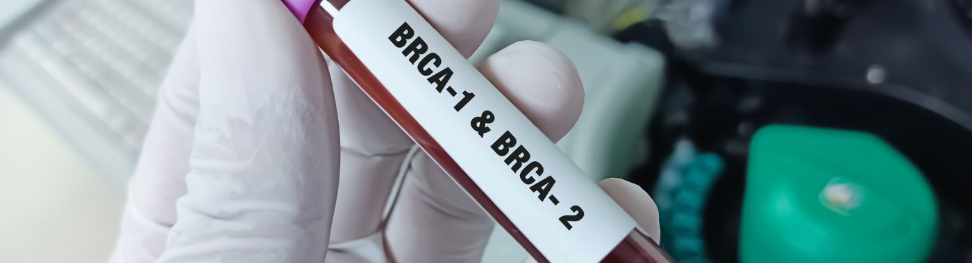 BRCA Testing