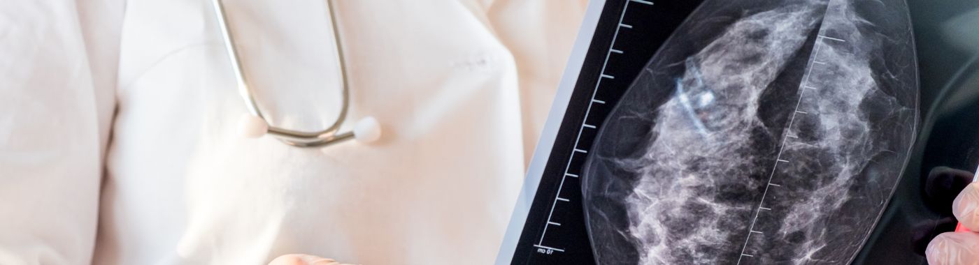 Breast MRI
