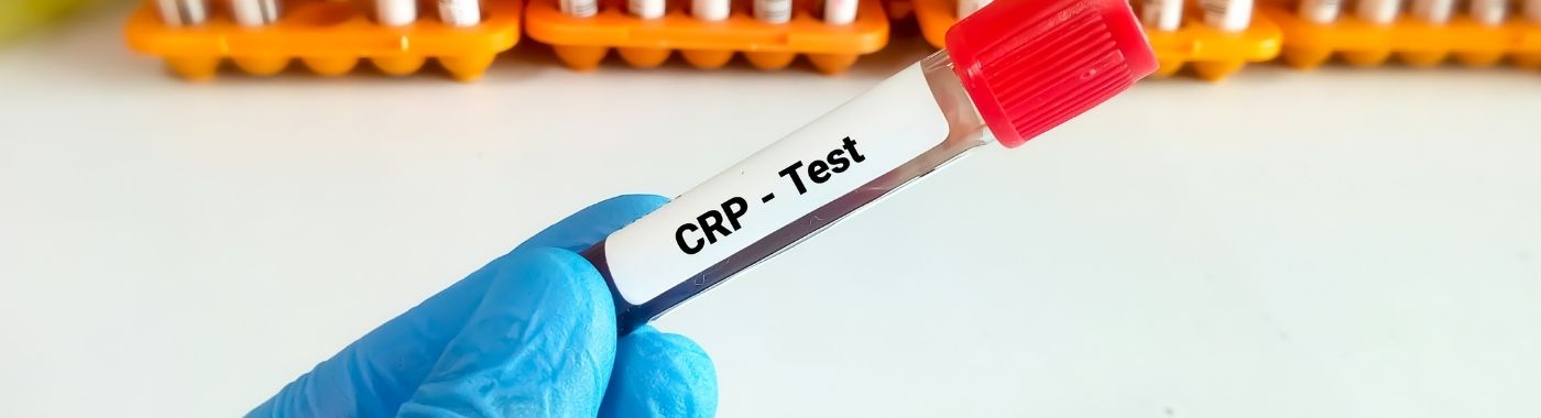 C-Reactive Protein Test