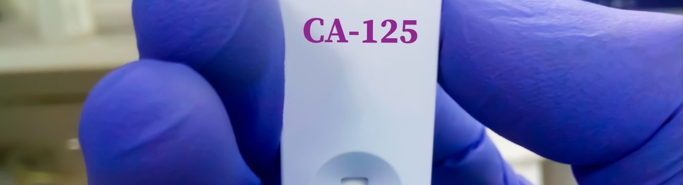 CA-125 Test