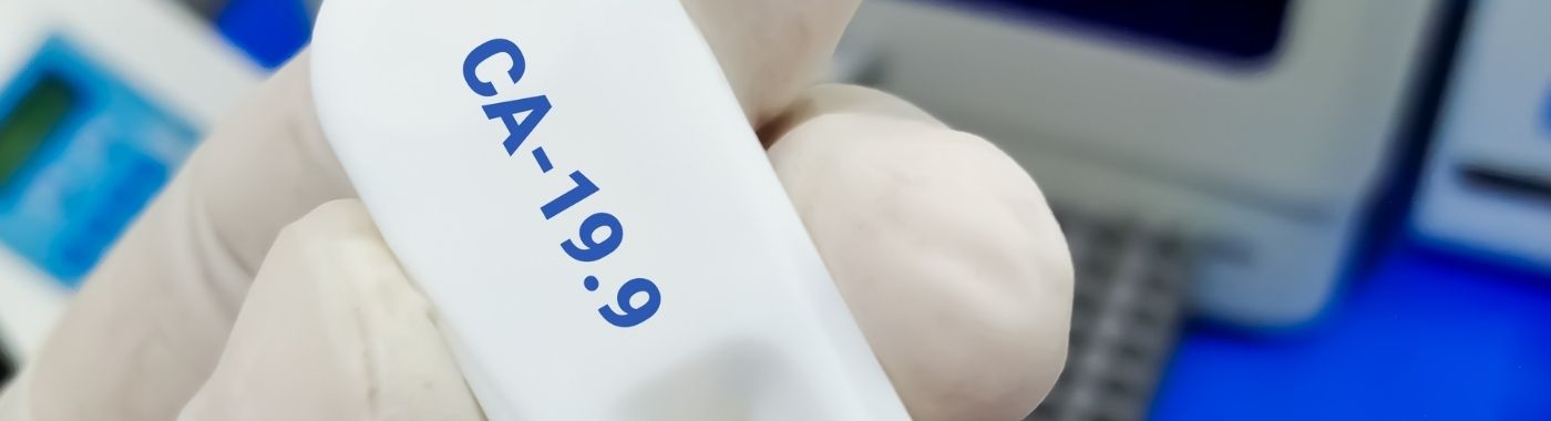 CA 19.9 Test