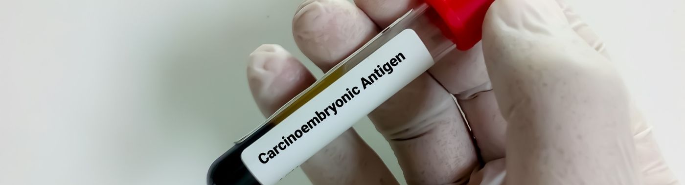 CEA Test
