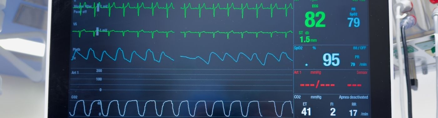 Cardiac Event Monitor