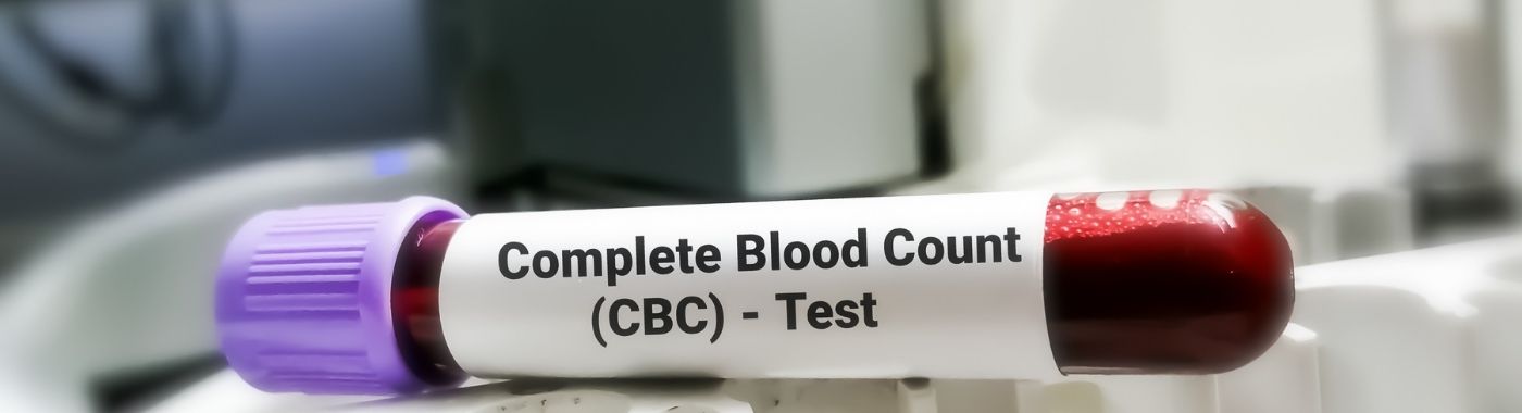 CBC Hemogram Test