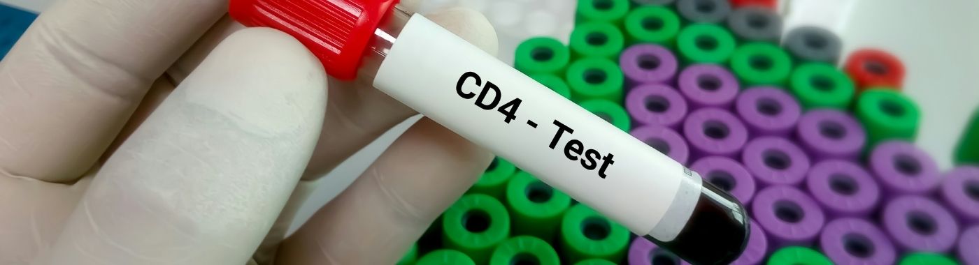 CD4 Test