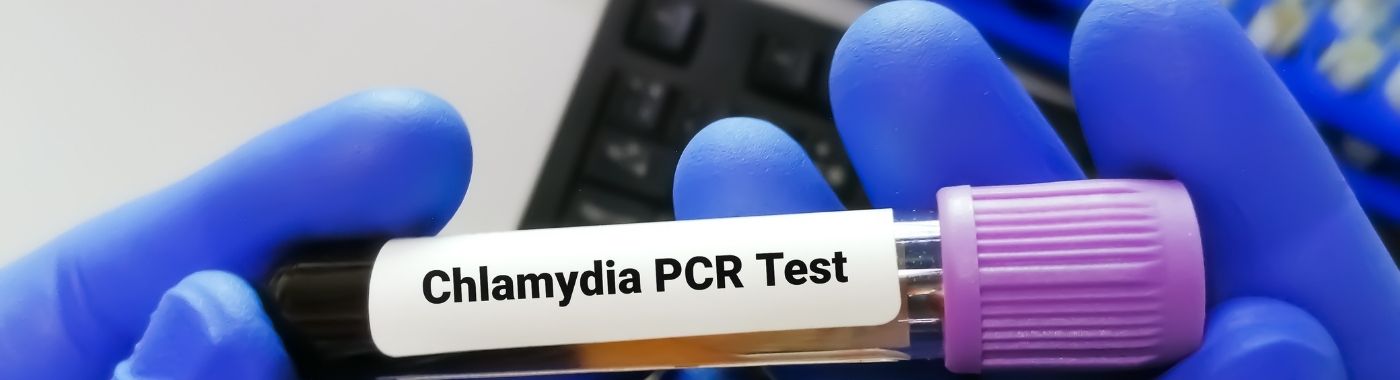 Chlamydia Test