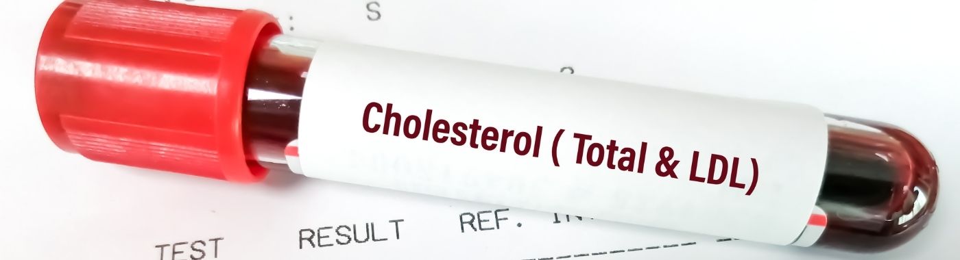Cholesterol Test
