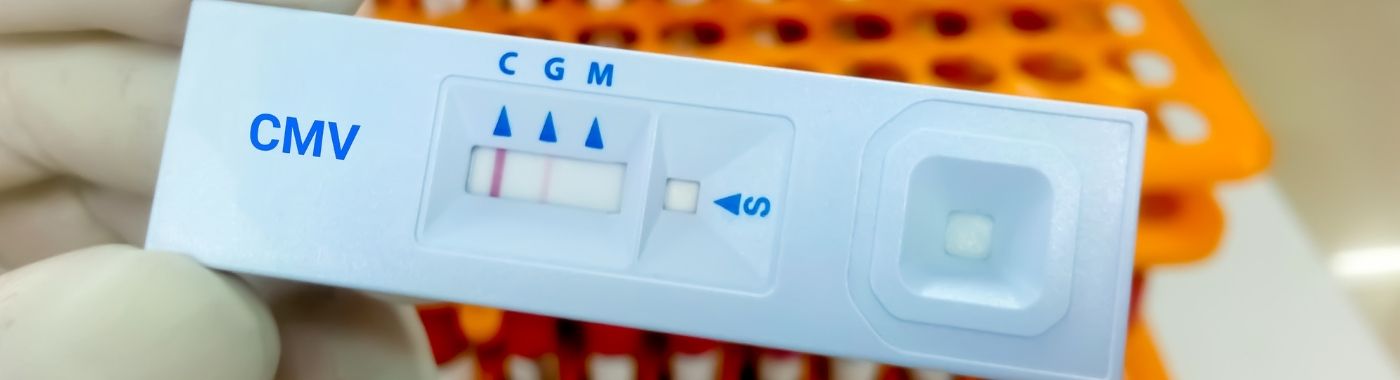 CMV Test