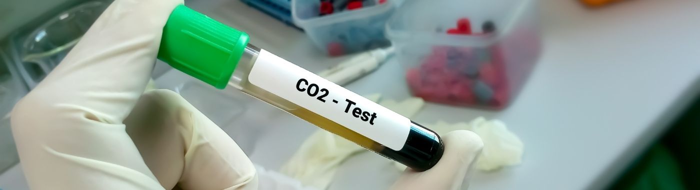 CO2 Blood Test