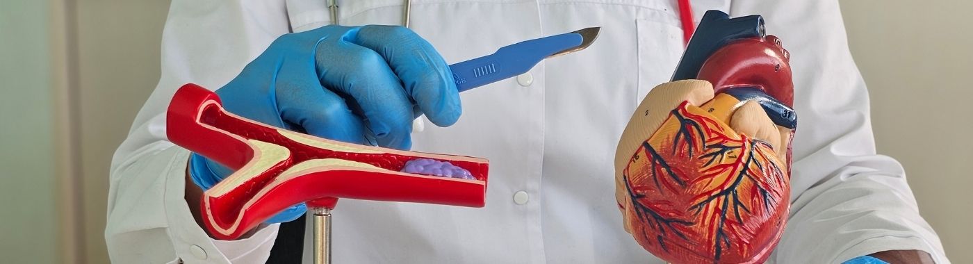 Coronary Flow Reserve