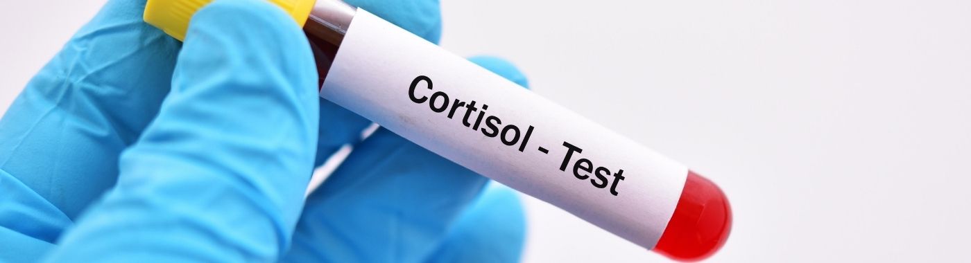 Cortisol Test