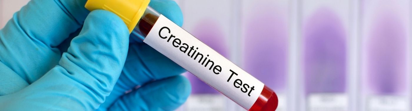 Creatinine Clearance Test