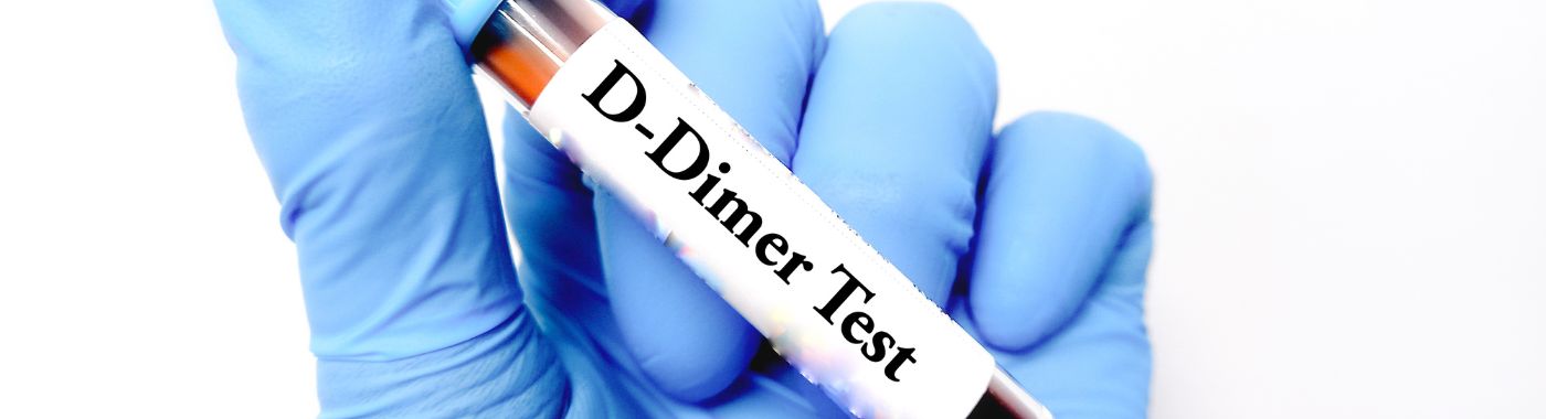 D Dimer Test
