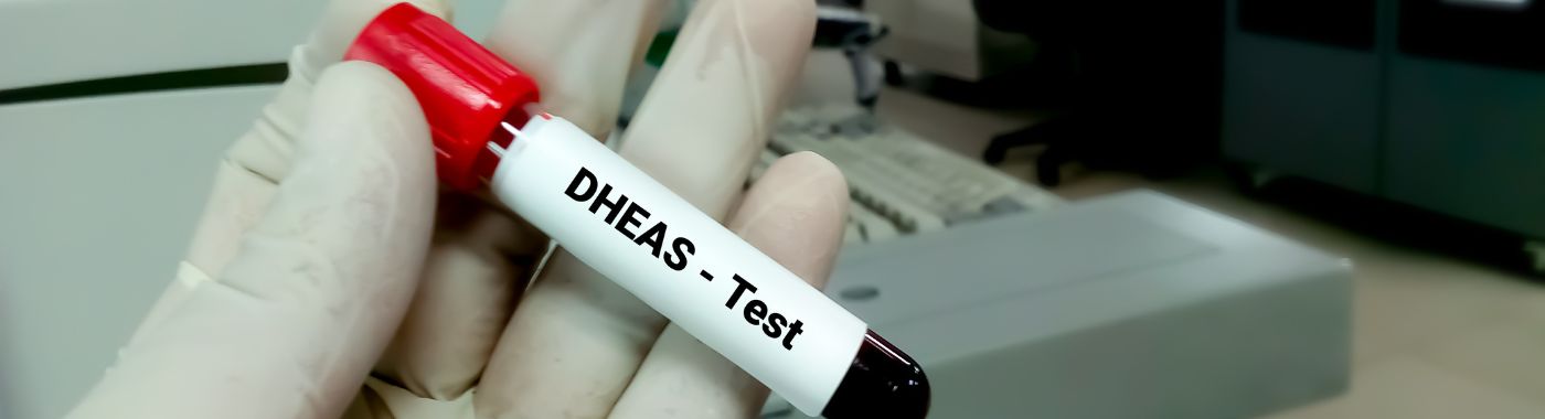 DHEAS Test
