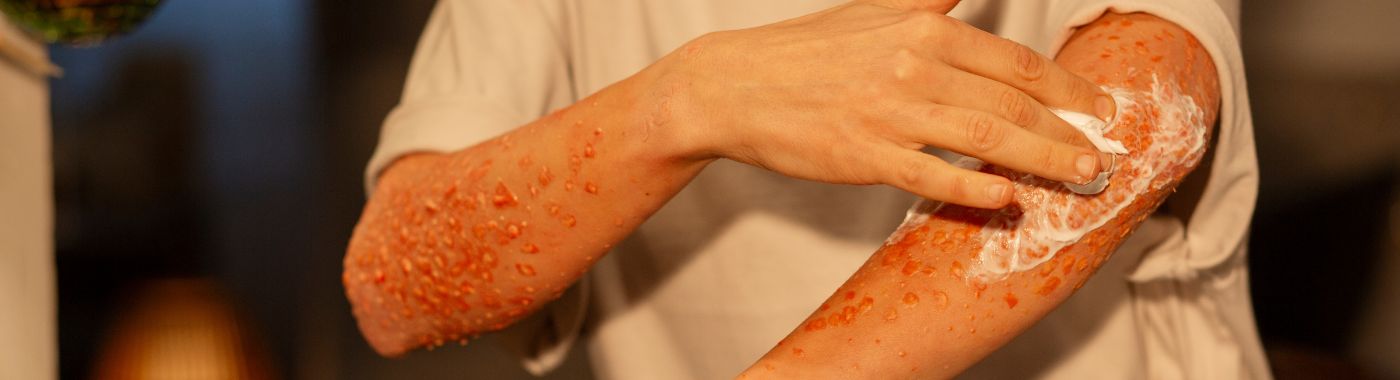 Dicloxacillin: Uses, Dosage, Side Effects and More