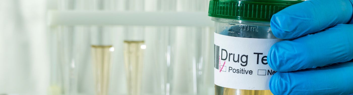 Drug Test