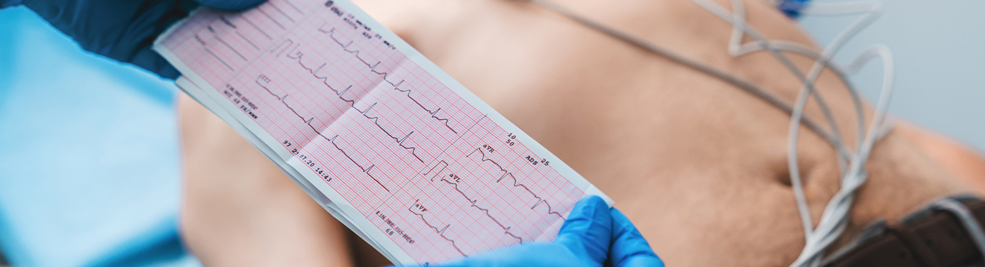 Electrocardiogram