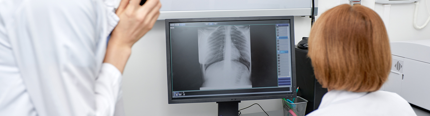 Endobronchial Ultrasound