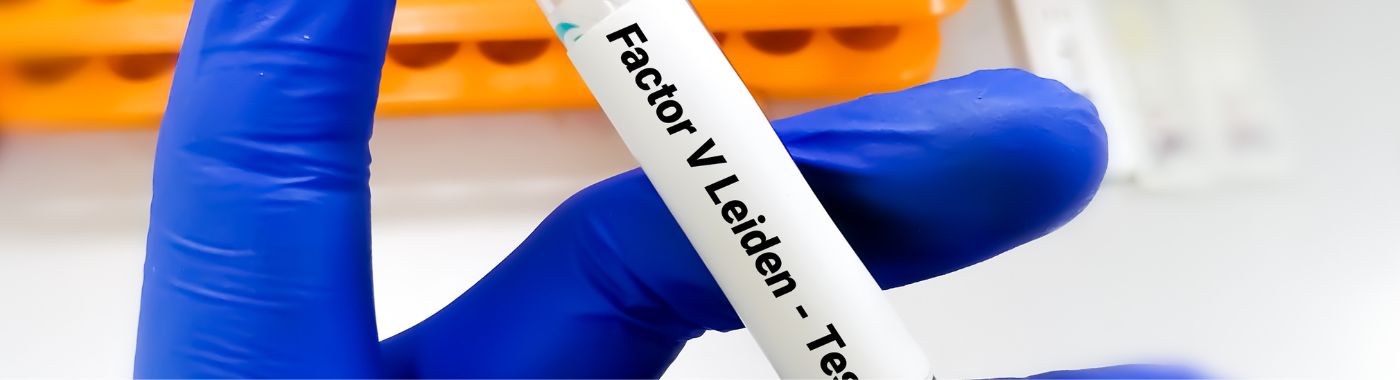 factor-v-leiden-test